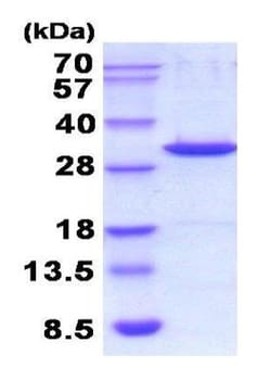 Abcam&nbsp;Recombinant Mouse Galectin 3 Protein, Active, 10 &mu;g