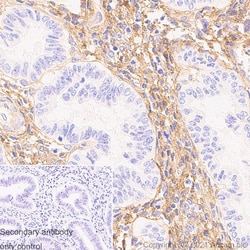 Abcam&nbsp;Anti-Pro-Collagen III Alpha 1 Antibody, Rabbit Multiclonal, 1 mL