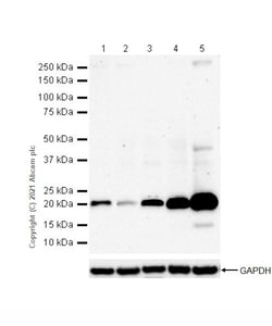 Abcam&nbsp;Anti-Ferritin Antibody [RM1036], Rabbit Multiclonal, 100 &mu;L