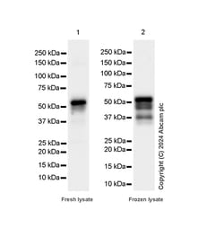 Abcam&nbsp;FOXA1 Multiclonal Antibody, Rabbit Host, BSA and Azide Free, 1 mg