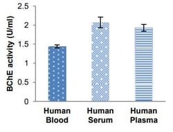 Abcam&nbsp;Butyrylcholinesterase Assay Kit, Colorimetric, 100 Tests