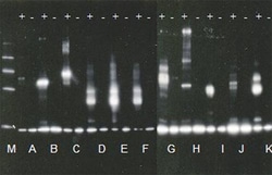 Abcam&nbsp;E2-Ubiquitin Conjugation Kit, Enzyme Activity Assay, 50 Test