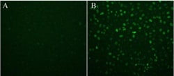 Abcam&nbsp;Gamma H2A.X Staining Kit, 100 Tests