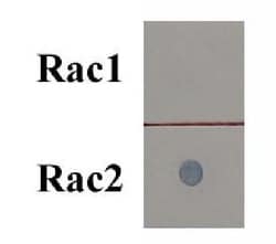 Abcam&nbsp;Rac2 Activation Assay Kit, Human, Mouse, 20 Tests