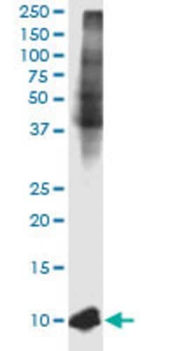 B2M Mouse anti-Human, Unconjugated, Clone: 3F9-2C2, Abnova 100 &mu;g; Unconjugated:Antibodies,