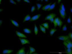 B2M Mouse anti-Human, Unconjugated, Clone: 3F9-2C2, Abnova 100 &mu;g; Unconjugated:Antibodies,
