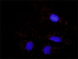 B2M Mouse anti-Human, Unconjugated, Clone: 3F9-2C2, Abnova 100 &mu;g; Unconjugated:Antibodies,