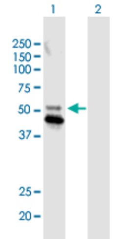 IDH2 Mouse anti-Human, Unconjugated, Clone: 5F11, Abnova 100 &mu;g | Buy Online | Abnova Corporation | Fisher Scientific