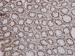 IDH2 Mouse anti-Human, Unconjugated, Clone: 5F11, Abnova 100 &mu;g | Buy Online | Abnova Corporation | Fisher Scientific