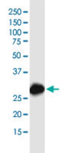 MTAP Mouse anti-Human, Mouse, Rat, Unconjugated, Clone: 2G4, Abnova 100