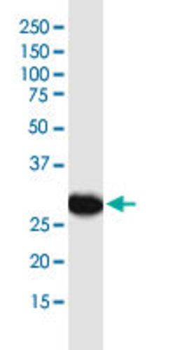 MTAP Mouse anti-Human, Mouse, Rat, Unconjugated, Clone: 2G4, Abnova 100