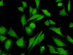 MTAP Mouse anti-Human, Mouse, Rat, Unconjugated, Clone: 2G4, Abnova 100