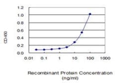 MTAP Mouse anti-Human, Mouse, Rat, Unconjugated, Clone: 2G4, Abnova 100