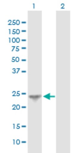 MTHFD2 Mouse anti-Human, Unconjugated, Clone: 4G7-2G3, Abnova 100 &mu;g;