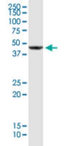 CD320 Mouse anti-Human, Mouse, Clone: 4F2, Abnova 100ug:Antibodies, Monoclonal