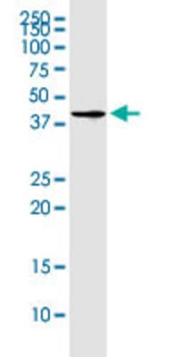 CD320 Mouse anti-Human, Mouse, Clone: 4F2, Abnova 100ug:Antibodies, Monoclonal