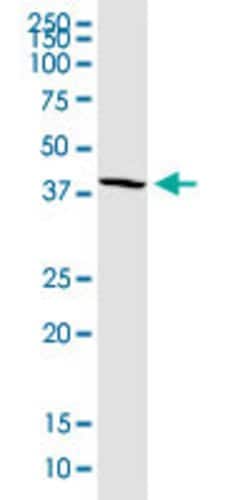 CD320 Mouse anti-Human, Mouse, Clone: 4F2, Abnova 100ug:Antibodies, Monoclonal
