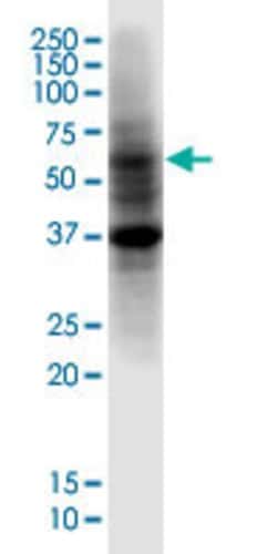PRDM14 Mouse anti-Human, Rat, Unconjugated, Clone: 5H2, Abnova 100 &mu;g;