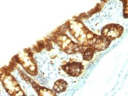 Tacstd1 Mouse anti-Rat, Clone: Epcam/1159, Abnova 500uL:Antibodies, Monoclonal