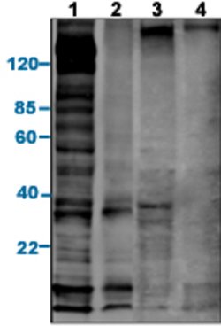 Phosphotyrosine Mouse, Clone: E10, Abnova 100ug:Anticuerpos