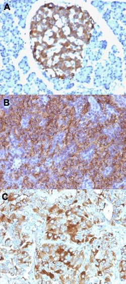 CHGA Mouse anti-Human, Clone: CHGA/765, Abnova 100ug:Antibodies, Monoclonal
