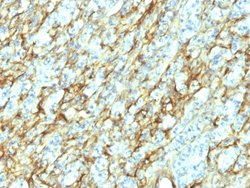 FN1 Mouse anti-Human, Clone: 568, Abnova 100ug:Antibodies, Monoclonal
