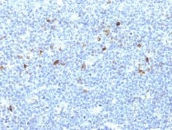 HLA-A25/HLA-Aw32 Mouse anti-Human, Clone: CATA-1, Abnova 100ug:Antibodies,