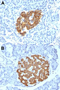 INS Mouse anti-Human, Rat, Clone: IRDN/794, Abnova 100ug:Antibodies, Monoclonal
