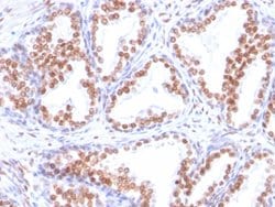 AR Mouse anti-Human, Clone: DHTR/882, Abnova 100ug:Antibodies, Monoclonal