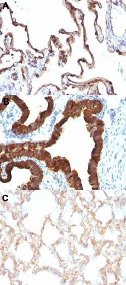 KRT7 Mouse anti-Human, Rat, Clone: KRT7/1198, Abnova 100ug:Anticuerpos