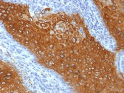KRT10 Mouse anti-Human, Clone: KRT10/844, Abnova 100ug:Antibodies, Monoclonal