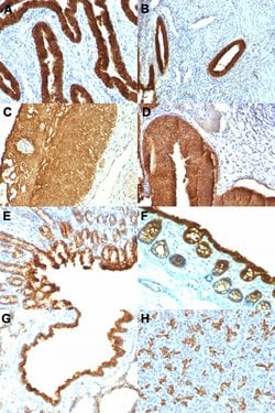 KRT19 Mouse anti-Human, Rat, Clone: KRT19/800, Abnova 100ug:Antibodies,