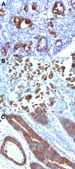 MUC3 Mouse anti-Human, Clone: MUC3/1154, Abnova 100ug:Antibodies, Monoclonal