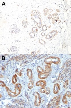 MYH11 Mouse anti-Human, Clone: ID8, Abnova 100 &mu;g | Buy Online | Abnova Corporation | Fisher Scientific