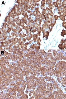 ODC1 Mouse anti-Human, Rat, Clone: ODC1/486, Abnova 100ug:Antibodies, Monoclonal
