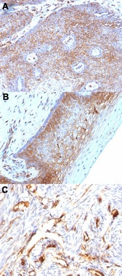 B2M Mouse anti-Human, Clone: B2M/1118, Abnova 100ug:Antibodies, Monoclonal