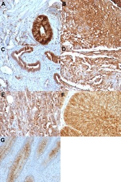 B2M Mouse anti-Human, Clone: B2M/961, Abnova 100 &mu;g | Buy Online | Abnova Corporation | Fisher Scientific