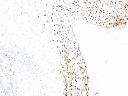 Human papilloma virus 16 Mouse, Clone: CAMVIR-1, Abnova 100ug:Antibodies,