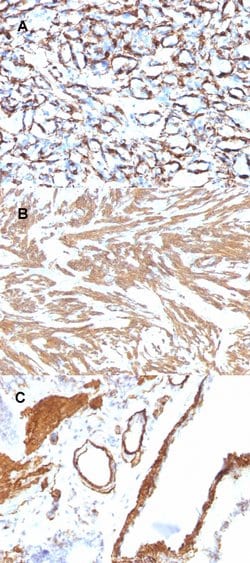 ACTA2 Mouse anti-Human, Rat, Clone: ACTA2/791, Abnova 100ug:Antibodies,