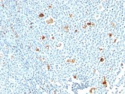 Calprotectin Mouse anti-Human, Clone: CPT/1028, Abnova 100ug:Antibodies,