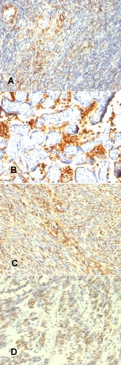 TGM2 Mouse anti-Human, Clone: TGM2/419, Abnova 100ug:Antibodies, Monoclonal