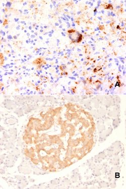 TNF Mouse anti-Human, Rat, Clone: TNF706, Abnova 100 &mu;g | Buy Online | Abnova Corporation | Fisher Scientific