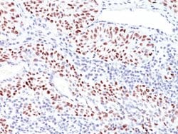 TP53 Mouse anti-Human, Clone: TRP/816, Abnova 100ug:Antibodies, Monoclonal