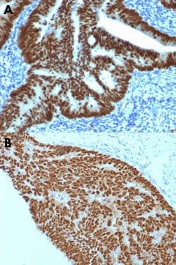 CDX2 Mouse anti-Human, Clone: CDX2/1690, Abnova™