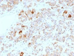 LH, alpha Mouse anti-Human, Clone: LHa/756, Abnova 100ug:Antibodies, Monoclonal