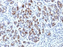 SERPINA3 Mouse anti-Human, Clone: AACT/1451, Abnova 100ug:Antibodies, Monoclonal