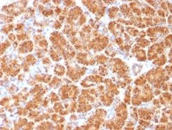CLTA/CLTB Mouse anti-Human, Clone: CLC/1421, Abnova™