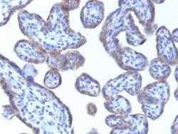 ADFP Mouse anti-Human, Clone: ADFP/1493, Abnova™