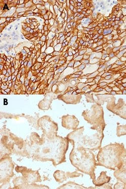 EGFR Mouse anti-Human, Clone: GFR/1708, Abnova™