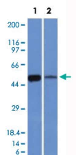 ALDH1A1 Mouse anti-Human, Clone: ALDH1A1/1381, Abnova 100ug:Antibodies,